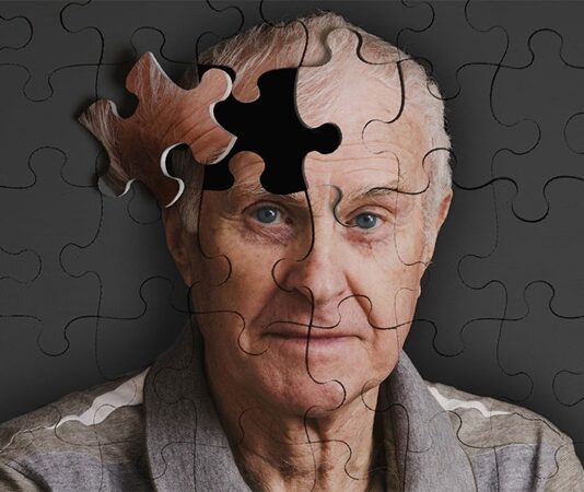 Yaşlanmayla birlikte bilişsel işlevlerde görülen gerileme, günümüzde birçok kişinin ortak kaygıları arasında yer alıyor. Özellikle Alzheimer hastalığı, hem bireyleri hem de ailelerini etkileyen önemli bir sağlık sorunu olarak öne çıkıyor. Bu noktada beslenme alışkanlıklarının beyin sağlığı üzerindeki rolü giderek daha fazla gündeme geliyor. Alzheimer önleyici MIND diyeti, zihinsel performansı desteklemeyi amaçlayan bütüncül bir beslenme yaklaşımı olarak dikkat çekiyor. Konulu bir haber görseli.