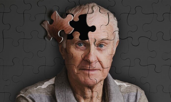 Yaşlanmayla birlikte bilişsel işlevlerde görülen gerileme, günümüzde birçok kişinin ortak kaygıları arasında yer alıyor. Özellikle Alzheimer hastalığı, hem bireyleri hem de ailelerini etkileyen önemli bir sağlık sorunu olarak öne çıkıyor. Bu noktada beslenme alışkanlıklarının beyin sağlığı üzerindeki rolü giderek daha fazla gündeme geliyor. Alzheimer önleyici MIND diyeti, zihinsel performansı desteklemeyi amaçlayan bütüncül bir beslenme yaklaşımı olarak dikkat çekiyor. Konulu bir haber görseli.