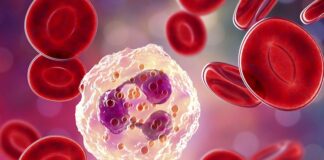 İnflamasyon, vücudun doğal savunma mekanizmasının bir parçası olsa da, kronik hale geldiğinde ciddi sağlık sorunlarına yol açabilir. Bu nedenle inflamasyon karşıtı diyet, hem inflamatuvar süreçleri azaltmak hem de genel sağlığı desteklemek için önemli bir beslenme yaklaşımı olarak öne çıkıyor. Antioksidan ve antiinflamatuvar özellik taşıyan besinlerin düzenli tüketimi, bağışıklık sistemini güçlendirir ve enerji seviyelerini dengeler. Konulu bir haber görseli.