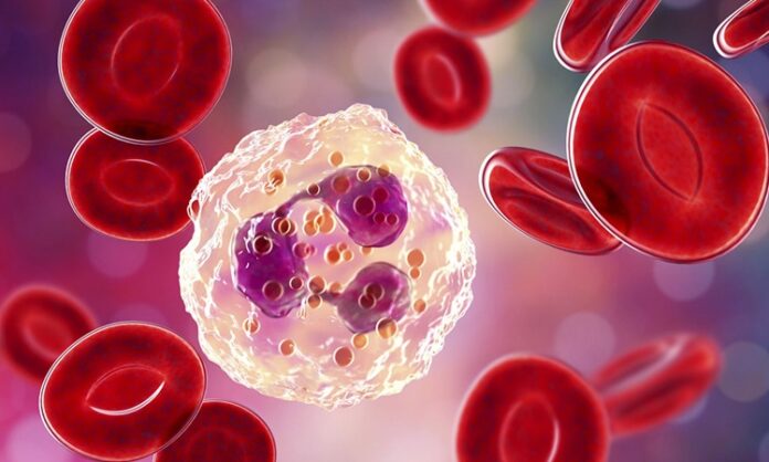 İnflamasyon, vücudun doğal savunma mekanizmasının bir parçası olsa da, kronik hale geldiğinde ciddi sağlık sorunlarına yol açabilir. Bu nedenle inflamasyon karşıtı diyet, hem inflamatuvar süreçleri azaltmak hem de genel sağlığı desteklemek için önemli bir beslenme yaklaşımı olarak öne çıkıyor. Antioksidan ve antiinflamatuvar özellik taşıyan besinlerin düzenli tüketimi, bağışıklık sistemini güçlendirir ve enerji seviyelerini dengeler. Konulu bir haber görseli.