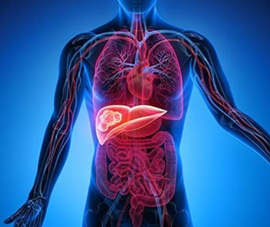 Karaciğer, vücudun en önemli detoks organlarından biridir ve sağlıklı çalışması genel sağlık açısından kritik bir rol oynar. Modern yaşamda işlenmiş gıdalar, alkol ve stres gibi faktörler karaciğerin yükünü artırabilir. Bu nedenle karaciğer temizleme diyeti, vücudu toksinlerden arındırmak, metabolizmayı desteklemek ve enerji seviyelerini yükseltmek için etkili bir yöntem olarak öne çıkıyor. Bu diyet, doğru uygulandığında hem besleyici hem de güvenli bir yaşam tarzı sağlar. Konulu bir haber görseli.