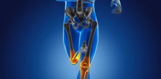 Kemik sağlığı, yaşamın her döneminde korunması gereken temel sağlık unsurlarından biridir. Çocukluk ve ergenlikte kemik gelişimi, yetişkinlikte kemik yoğunluğunun korunması, ileri yaşlarda ise kemik kaybının yavaşlatılması büyük önem taşır. Bu süreçlerin tamamında kemik güçlendirici diyet, iskelet sistemini destekleyen en etkili yaşam tarzı unsurlarından biri olarak öne çıkar. Doğru beslenme alışkanlıkları, kemiklerin dayanıklılığını artırırken kırık ve osteoporoz riskini azaltmaya yardımcı olur. Konulu bir haber görseli.