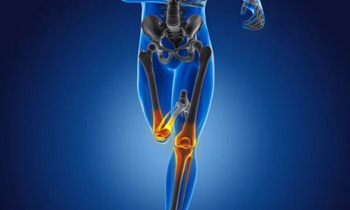 Kemik sağlığı, yaşamın her döneminde korunması gereken temel sağlık unsurlarından biridir. Çocukluk ve ergenlikte kemik gelişimi, yetişkinlikte kemik yoğunluğunun korunması, ileri yaşlarda ise kemik kaybının yavaşlatılması büyük önem taşır. Bu süreçlerin tamamında kemik güçlendirici diyet, iskelet sistemini destekleyen en etkili yaşam tarzı unsurlarından biri olarak öne çıkar. Doğru beslenme alışkanlıkları, kemiklerin dayanıklılığını artırırken kırık ve osteoporoz riskini azaltmaya yardımcı olur. Konulu bir haber görseli.